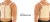 pas-piersiowy-meski-torako-z-usztywnieniem-kompresyjny-oddychajacy-ot-16-reh4mat-11.webp