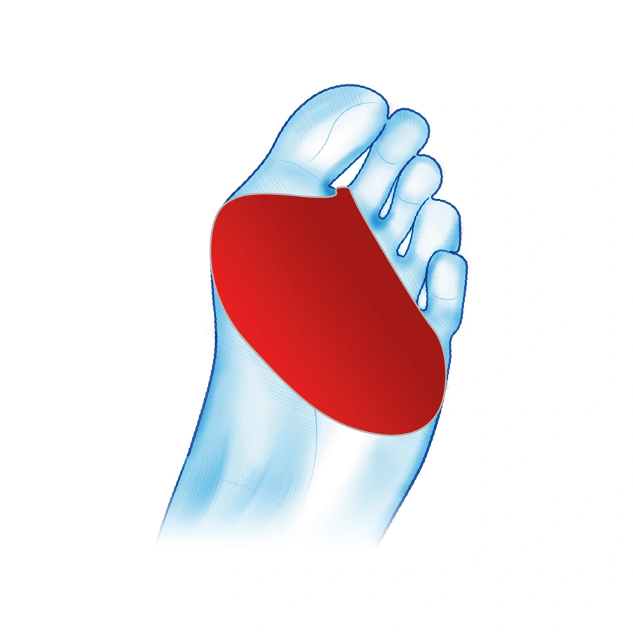 opaska-na-plaskostopie-poprzeczne-z-zelowa-pelota-redukujaca-bol-mazbit-2.webp
