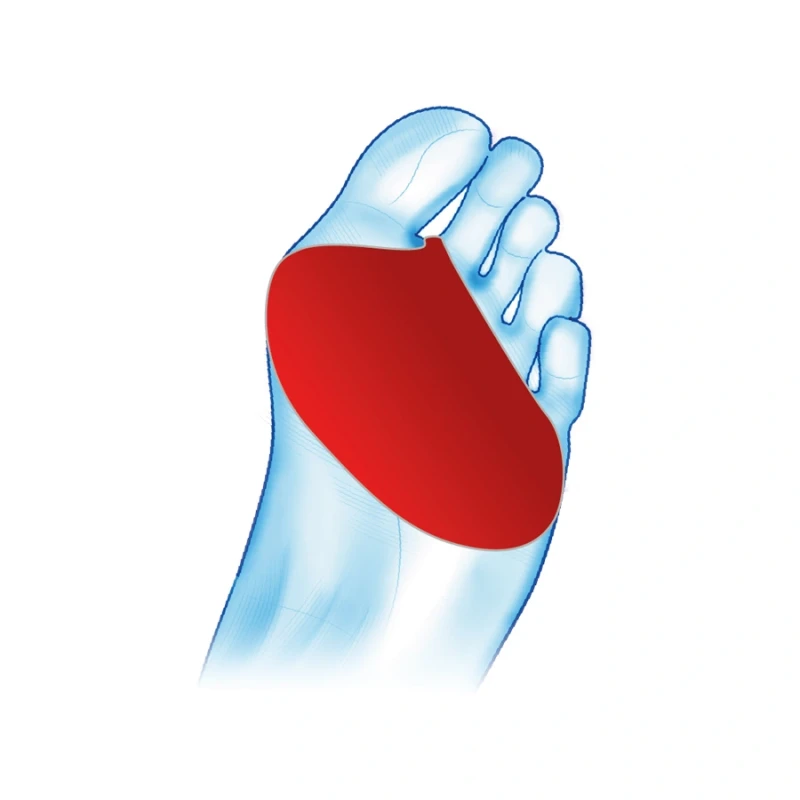 opaska-na-plaskostopie-poprzeczne-z-zelowa-pelota-redukujaca-bol-mazbit-2.webp