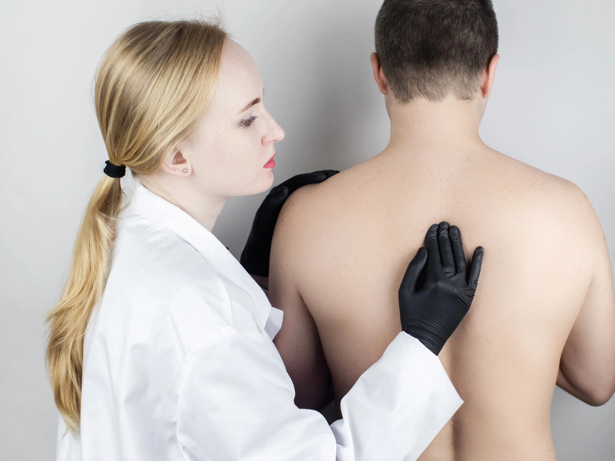 Kifoza - przyczyny, objawy i leczenie