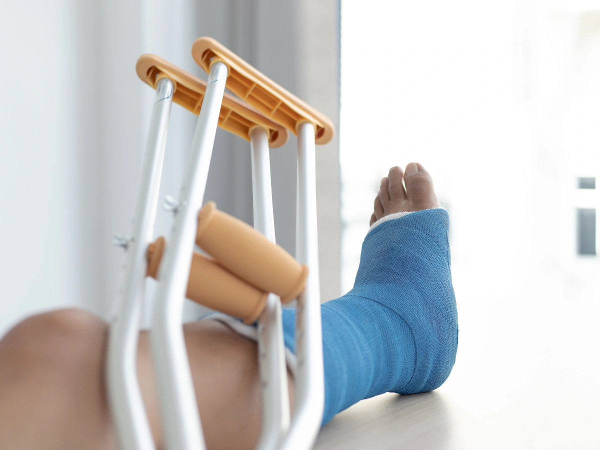 Złamanie kostki - diagnostyka, leczenie i rehabilitacja