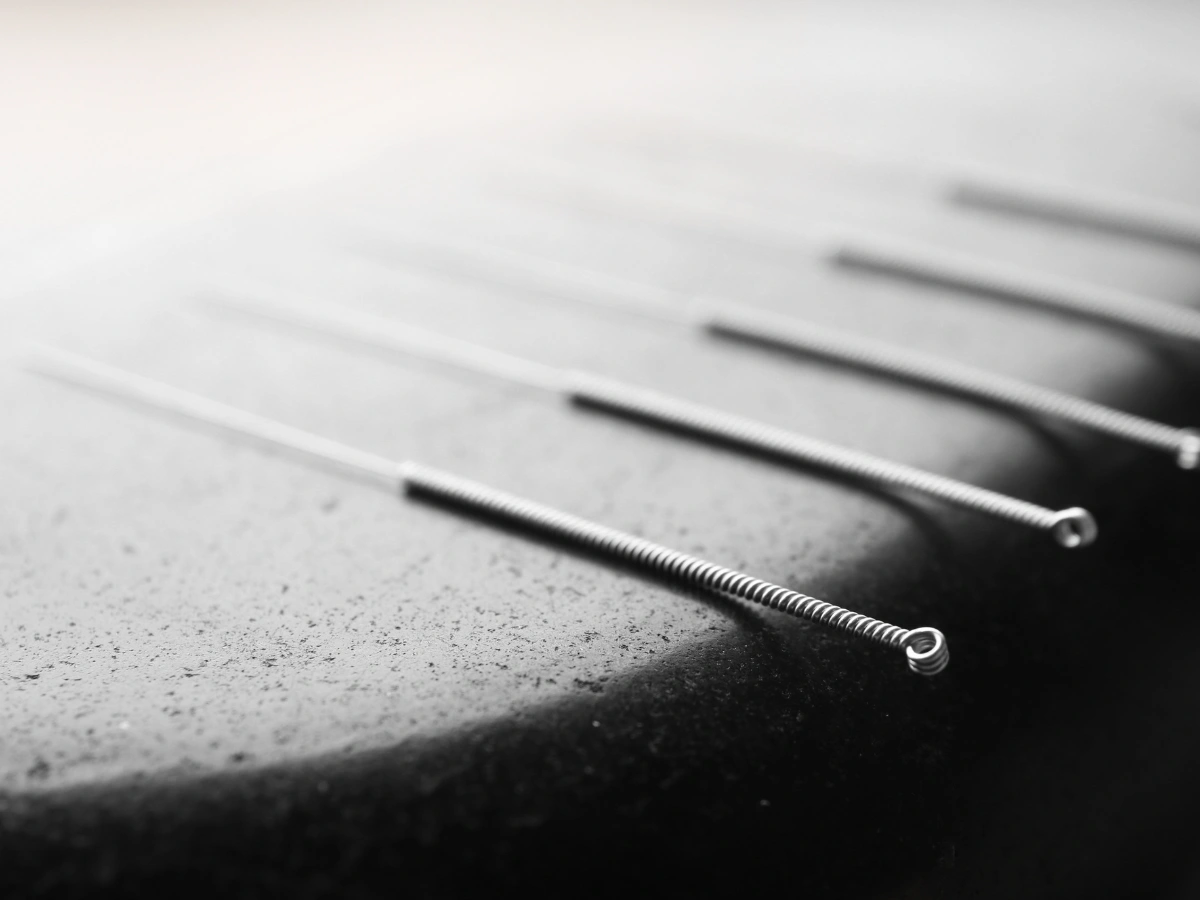 Suche igłowanie i akupunktura. Na czym polega terapia igłami i kiedy warto spróbować?